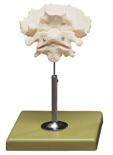 Atlas, Axis and Squamous Part of the Occipital Bone