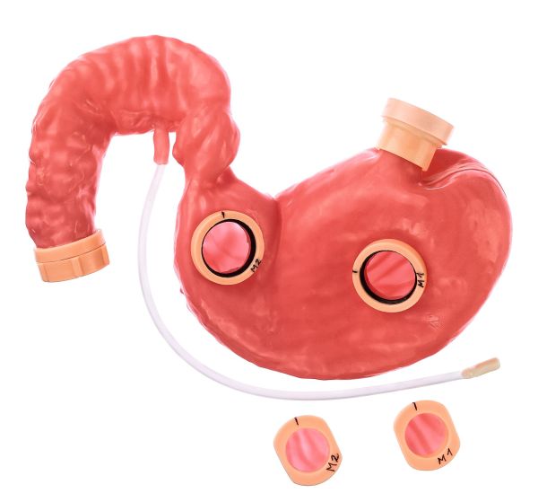 Stomach and duodenum, soft/elastic, with two windows