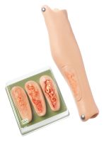 Unterschenkel, rechts, mit 4 Ulcus-cruris-Einsätzen Unterschenkel, rechts, mit 4 Ulcus-cruris-Einsätzen