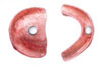 Gebiss, Ober- u. Unterkiefer mit Magnetverbindung Gebiss, Ober- u. Unterkiefer mit Magnetverbindung