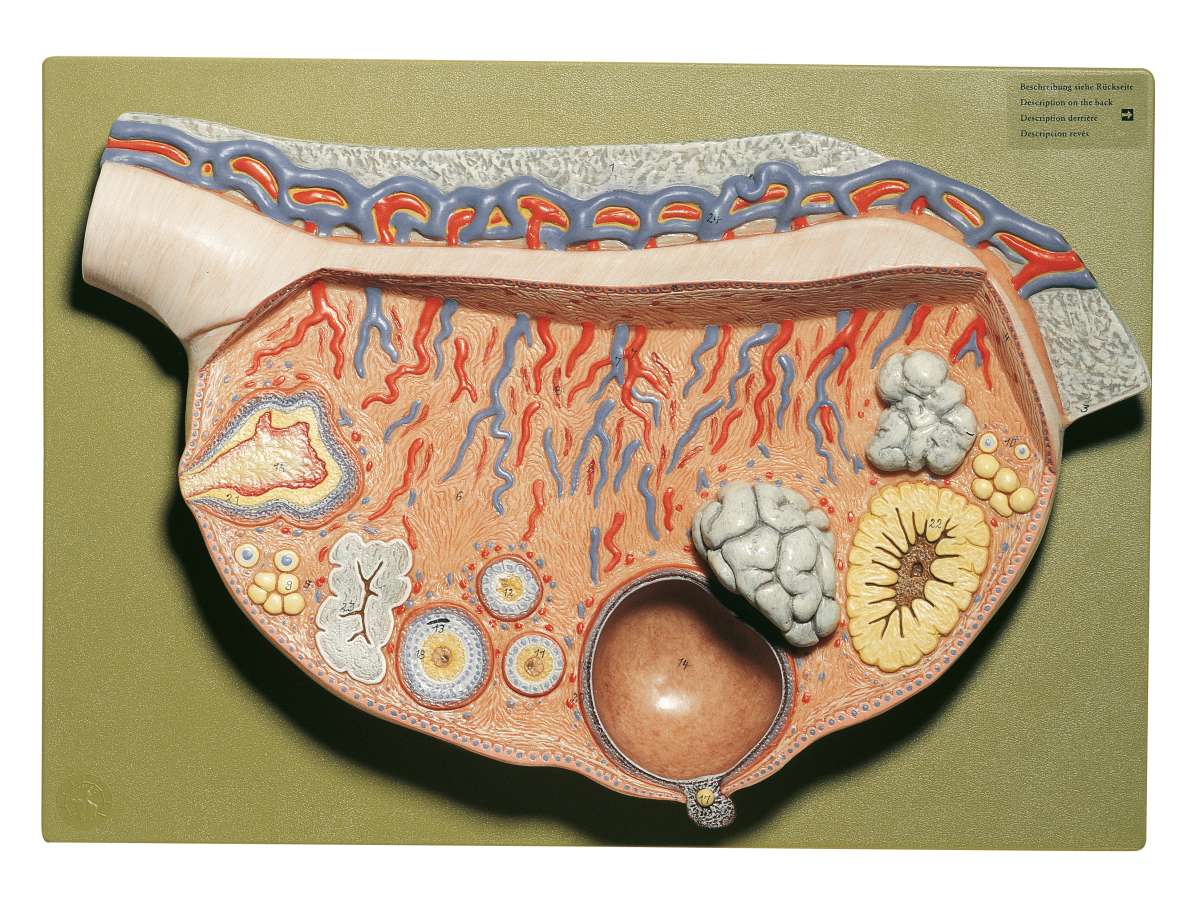 Reliefmodell Vom Eierstock | Weibliche Organe | Embryologie ...