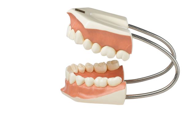 Model of a Set of Teeth