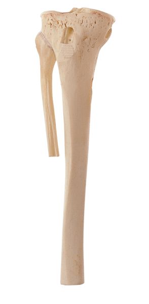 Lower leg bone