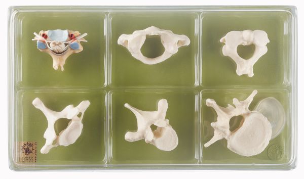 Case with Collection (Vertebrae and Spinal Cord)