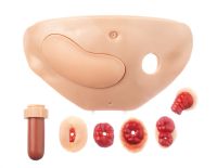 Bauchdecke mit 5teiligem Stomasatz und Diabetes-Spritzkissen Bauchdecke mit 5teiligem Stomasatz und Diabetes-Spritzkissen