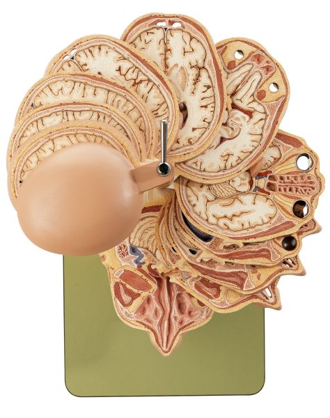 Anatomisches Schnittmodell des Kopfes (in Verbindung mit entsprechenden CT- und MR-Aufnahmen)