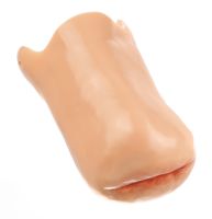 Unterschenkelstumpf mit Rötung, rechts Unterschenkelstumpf mit Rötung, rechts