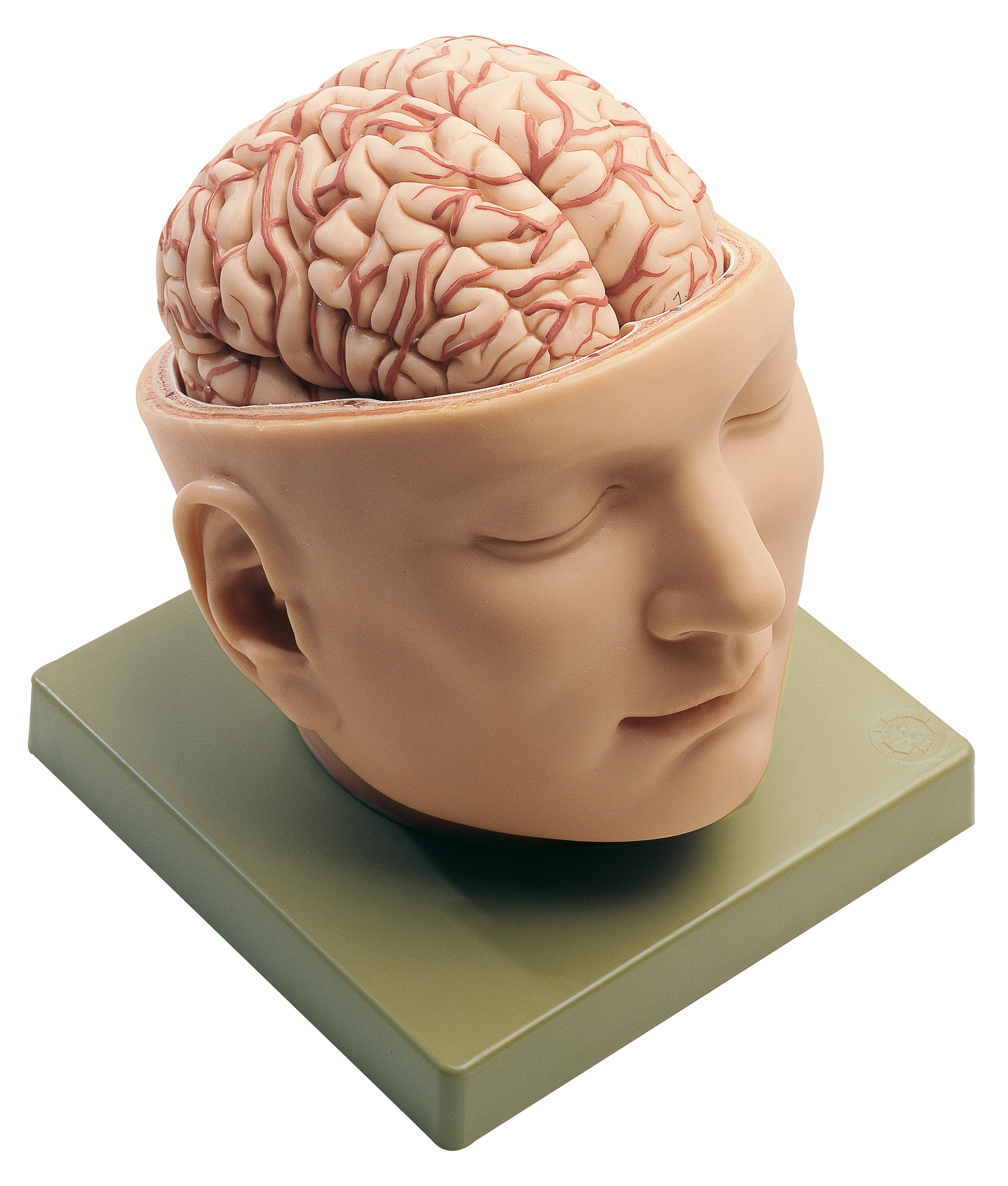 Мозг затылок. Мозг в голове. Человеческая голова.