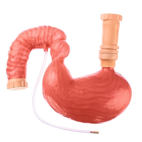 Stomach and duodenum, soft/elastic