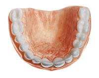 Gebiss für den Oberkiefer Gebiss für den Oberkiefer