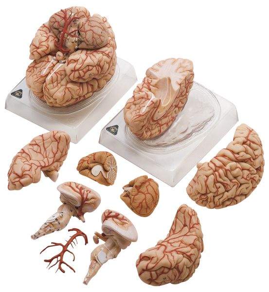 Gehirn mit Arterien
